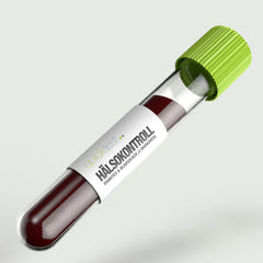 Hälsokontroll Diabetes & blodsocker - 3 markörer